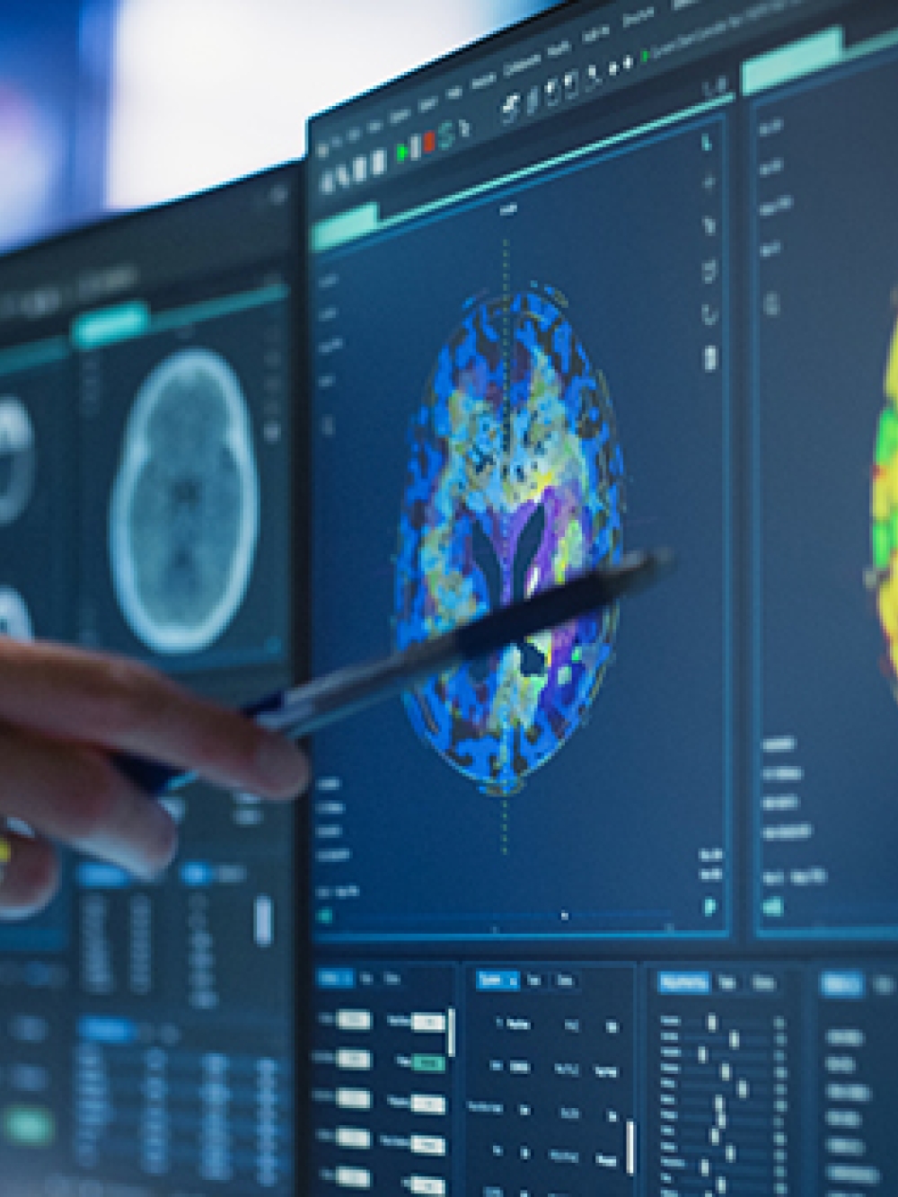 Écran d’analyse médicale affichant des images cérébrales colorées, avec une main pointant l’un des résultats à l’aide d’un stylet.